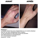 Bio-Alpennessel Pflegeöl | Hals, Dekolleté, Körper und Haare | 50 ml