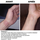 Huile de soin Ortie des Alpes BIO | Cou, Décolleté, Corps et Cheveux | 50 ml